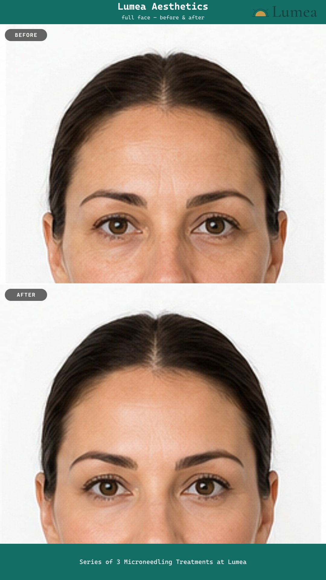Story-sized before and after export from VISTA, using AI-generated illustrative photos