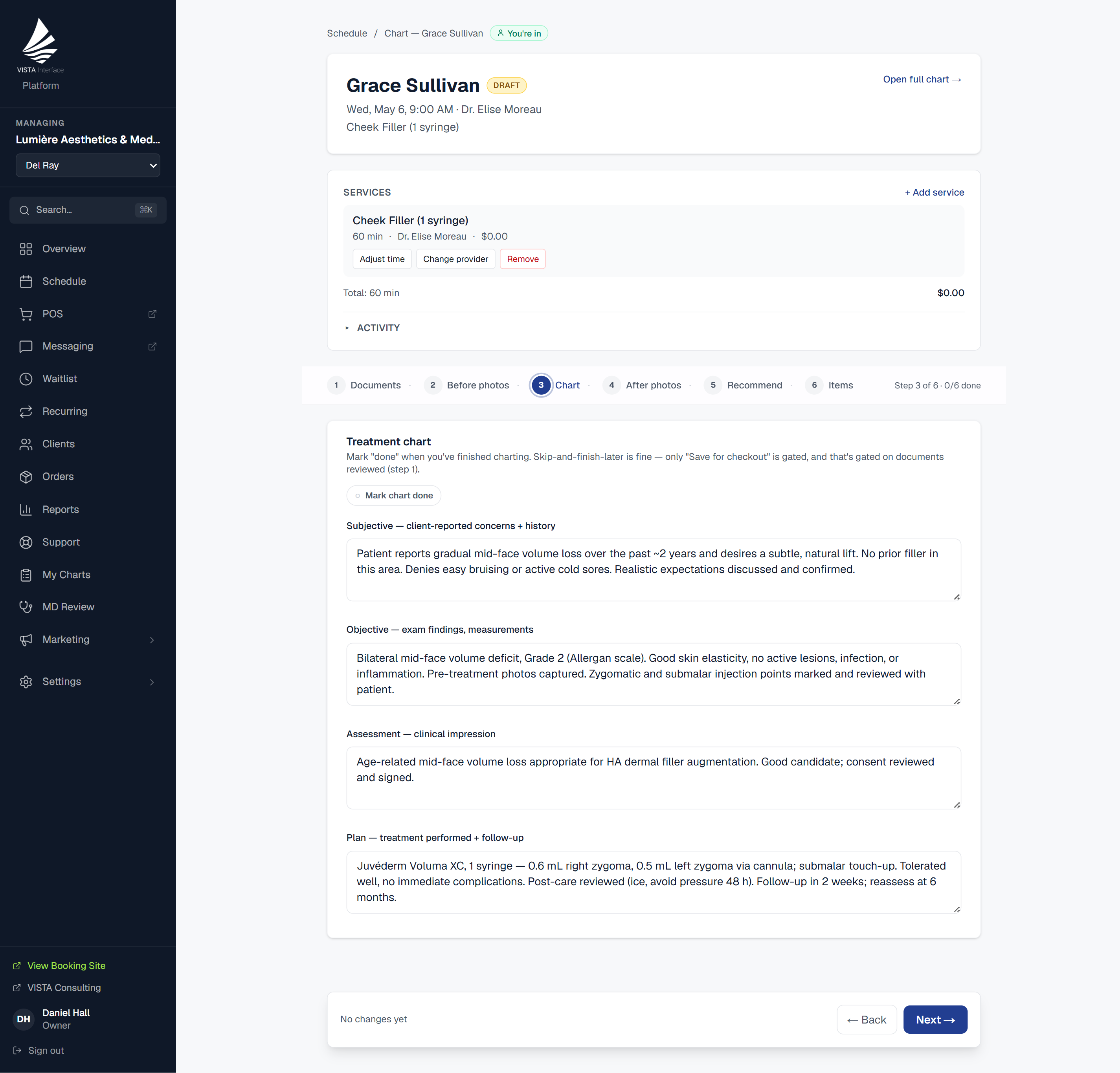 VISTA EHR — custom SOAP note with before & after photos